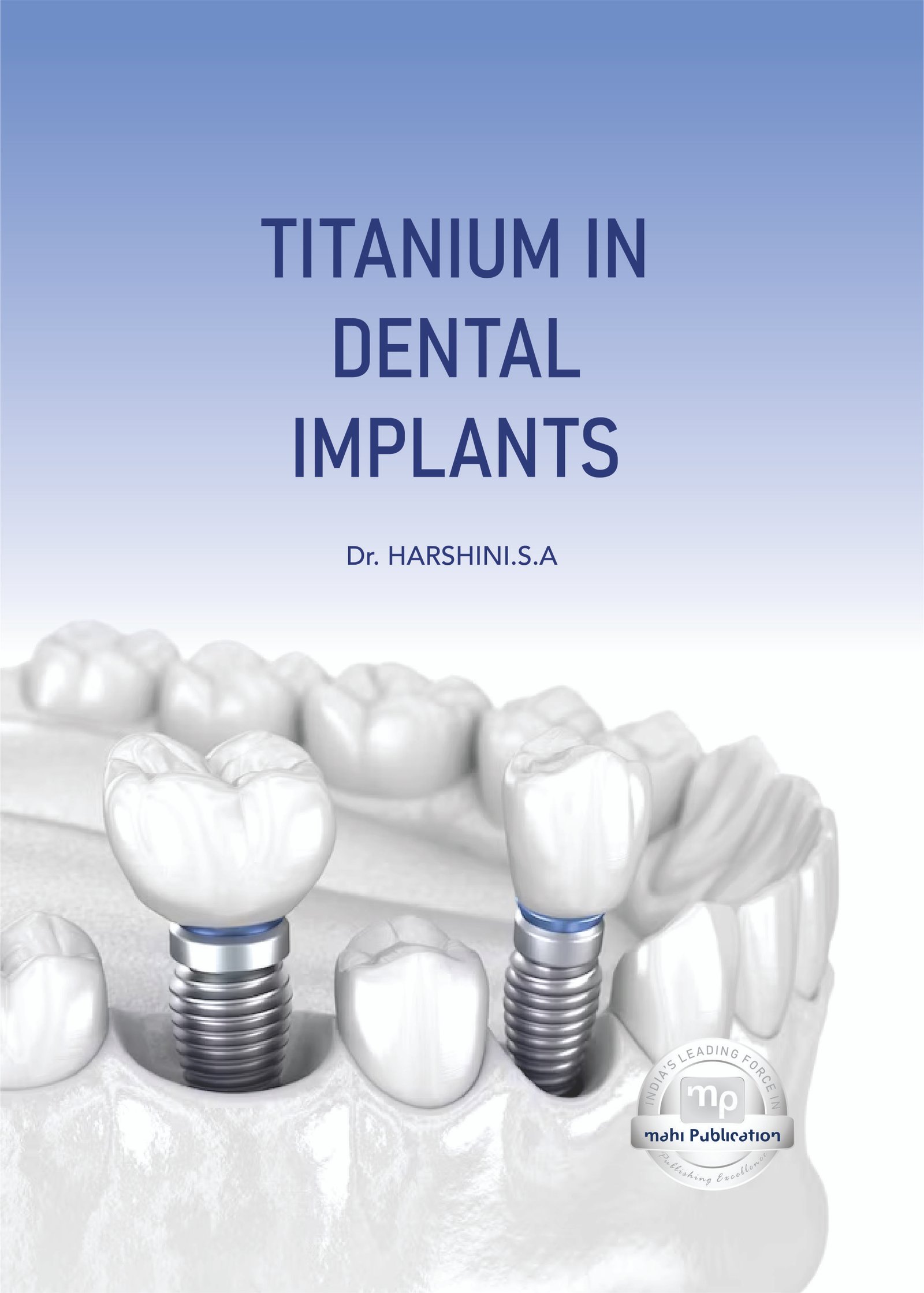 Titanium in Dental Implants