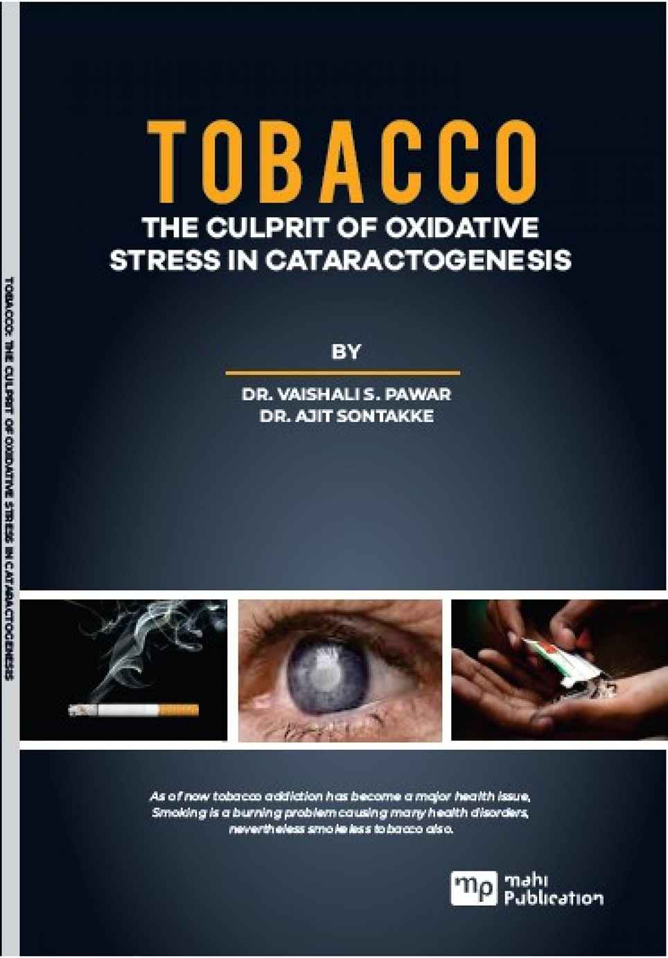 Tobacco The Culprit Of OXIdative Stress In Cataractogenesis