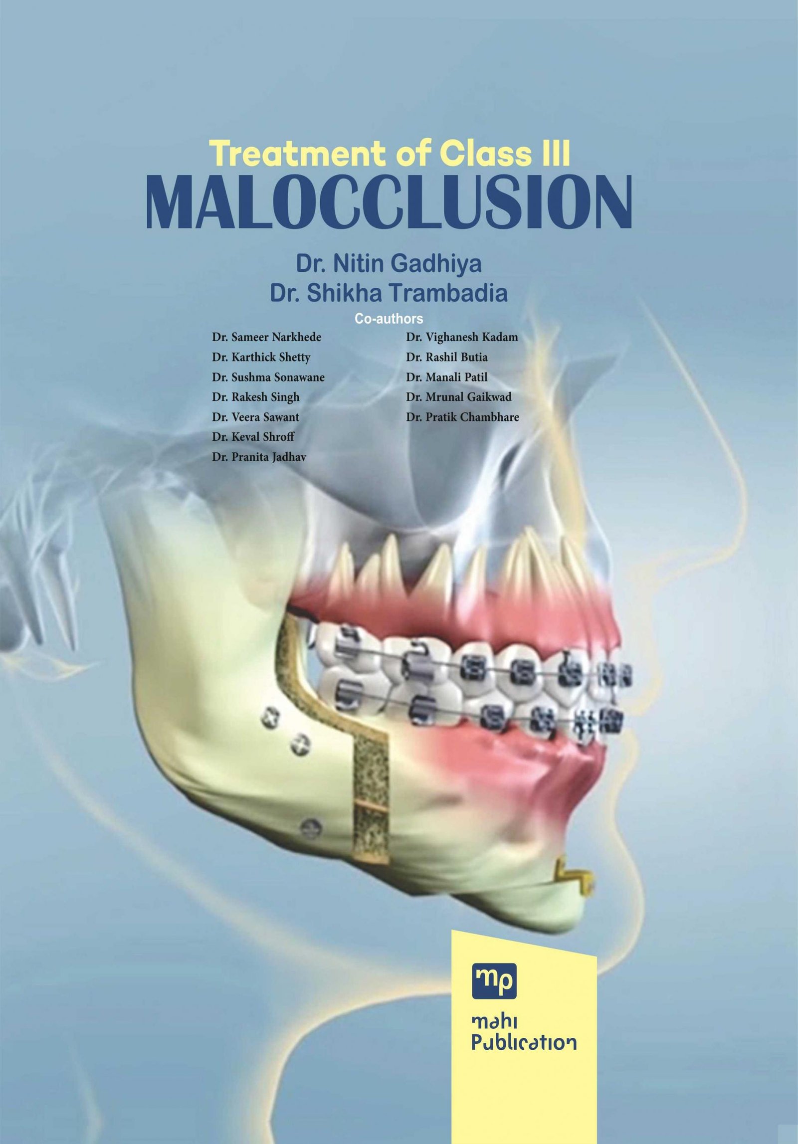 Treatment of Class III Malocclusion