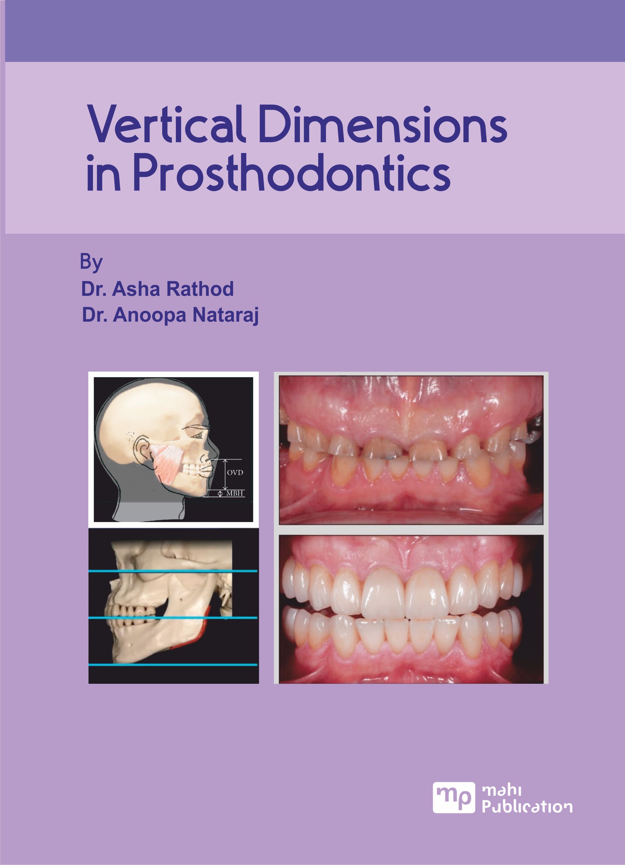 Vertical Dimensions In Prosthodontics